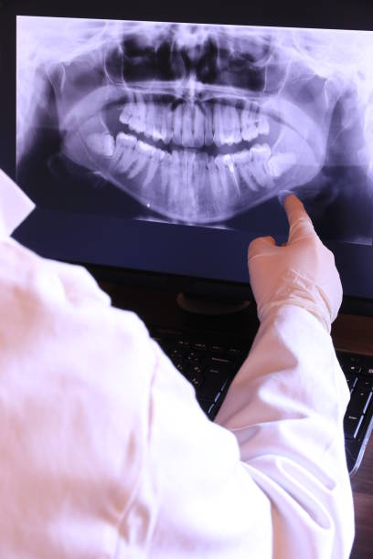Best Emergency Tooth Extraction in Bartonville, TX