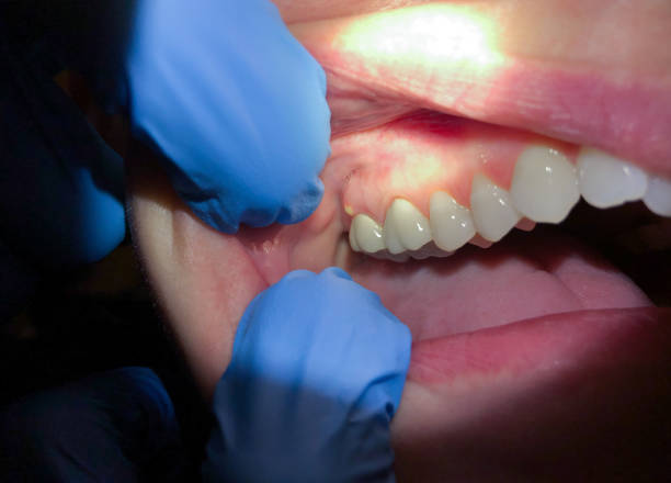 Best Emergency TMJ Treatment in Bartonville, TX