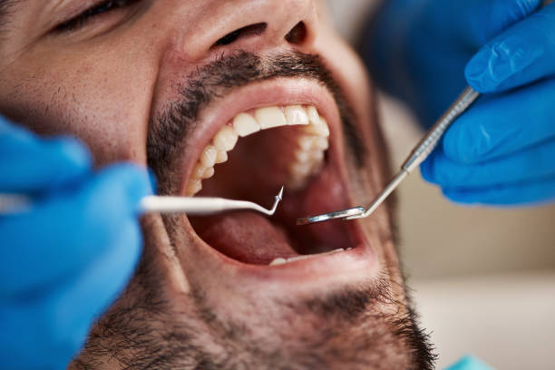 Best Emergency Treatment for Dental Infections or Abscesses in Bartonville, TX